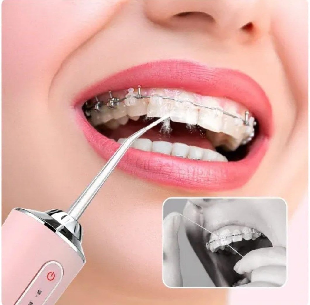 جهاز تنظيف الاسنان بالماء من بقايا الطعام والرواسب ب 3 مستويات مختلفة