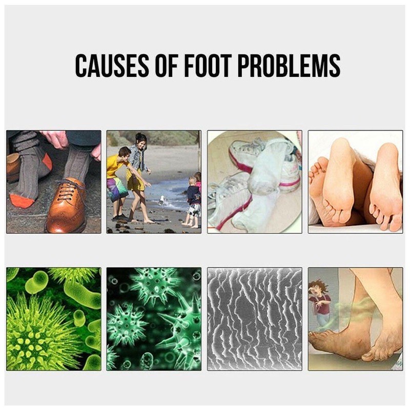 مزيل رائحة الشوز