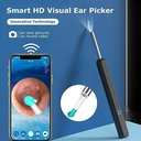 جهاز ديجيتال لتنظيف الاذن وازالة الشمع مزود بكاميرة