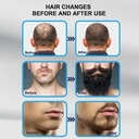 قلم ديرما ستامب قابل للتعديل لنمو الشعر واللحية وعلاج ندبات الوجه _ مقاس (0 مم – 3 مم)