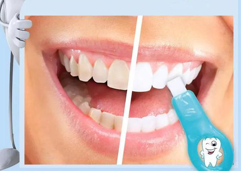 اداة تبيض الاسنان