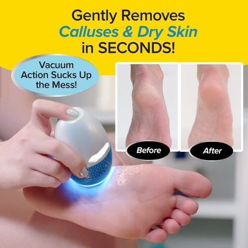 حجر كهربائي لإزالة الجلد الميت من القدمين بسرعة 2000 دورة في الدقيقة